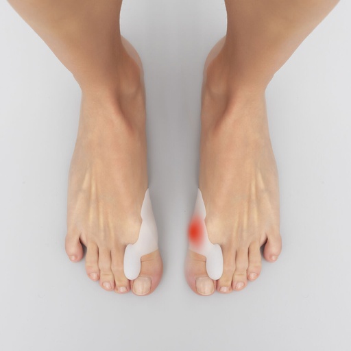 Correttore e protettore per calli in silicone Bunilief InnovaGoods Confezione da 2 unità